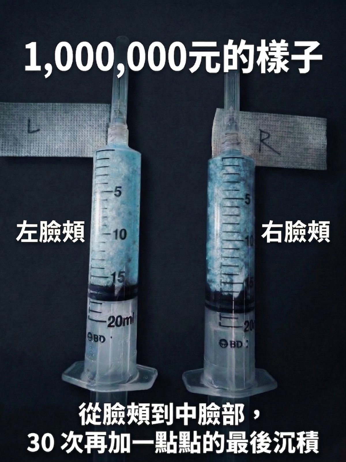 一個人的臉上可以塞進多少東西？