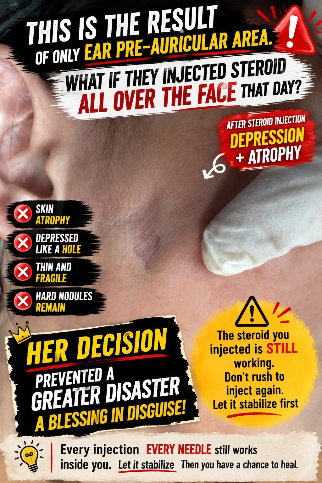 Juvelook Lumps: The Risks of Steroids and a Patient's Wise Decision