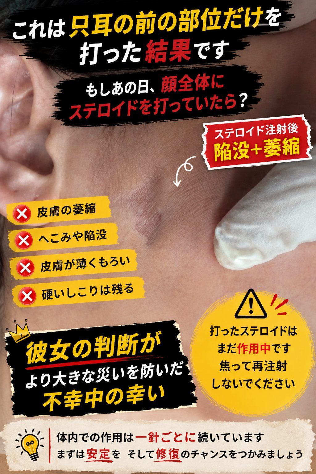 ジュベルック（Juvelook）によるしこりの治療：ステロイドのリスクと患者様の賢明な決断