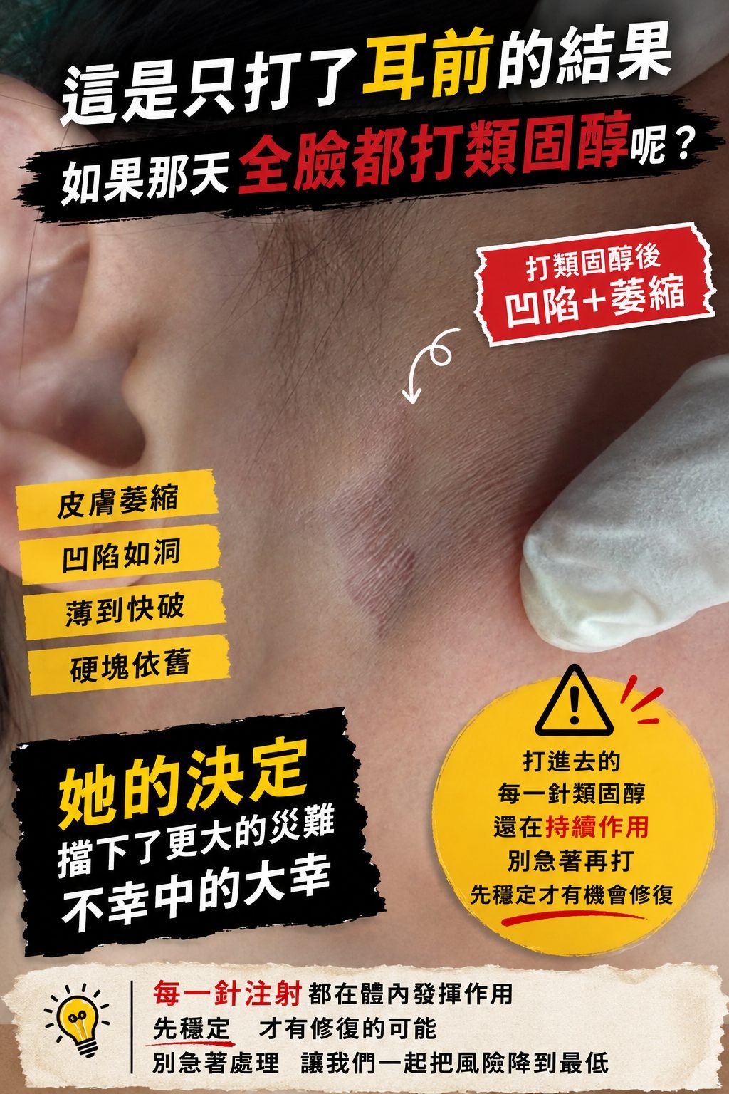 喬雅露Juvelook硬塊處理：類固醇的風險與患者的明智抉擇