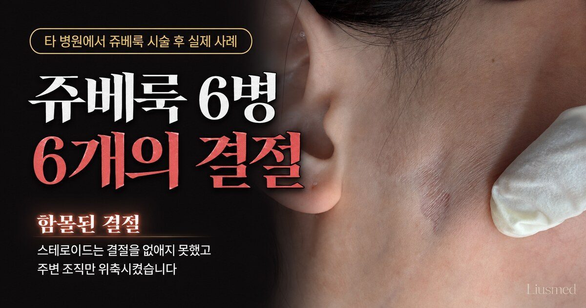 쥬베룩(Juvelook) 시술 후 경결 처리: 스테로이드의 양날의 검