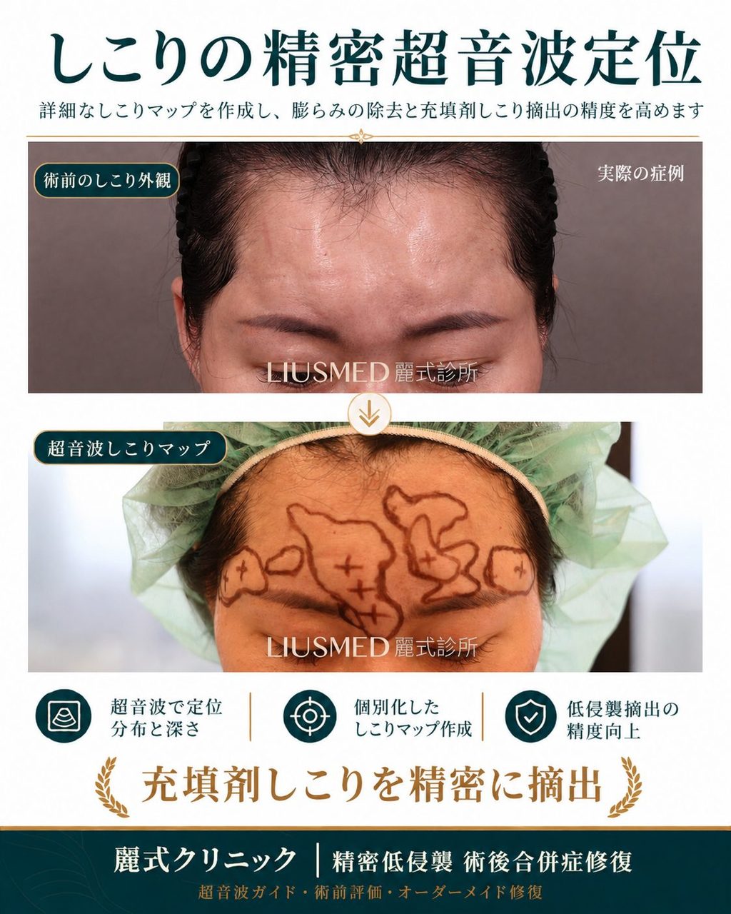 「顔に5つの傷跡が残るのでしょうか？」