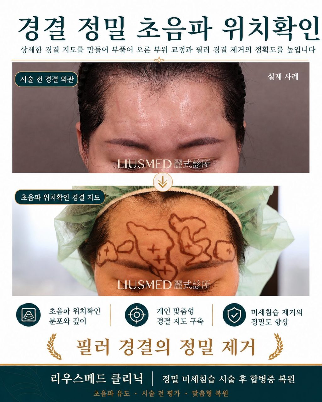 「그래서... 제 얼굴에 다섯 개의 흉터가 남나요?」